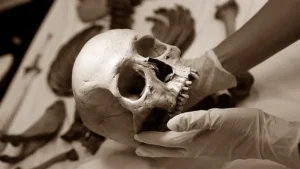 skeleton
