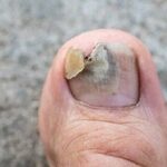119078_thumb