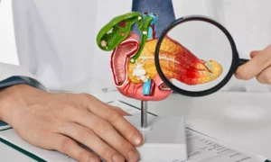 18795242-pancreas