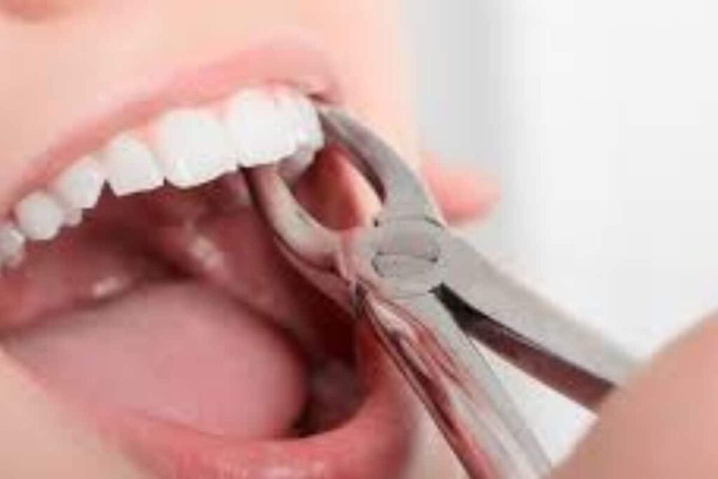 Teeth-2025-12-d966ffc0299da2d0ceaaee4bf8d9cea7-3x2-1