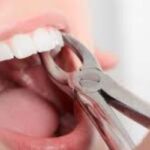 Teeth-2025-12-d966ffc0299da2d0ceaaee4bf8d9cea7-3x2-1