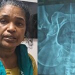 Kerala-surgery-2026-02-6c77d8e49521ea4a0e41d9a5823bb9cb-3x2-1