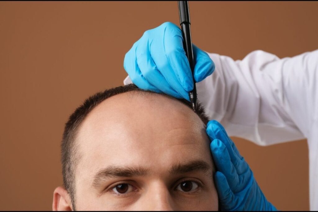 hair-transplant-surgery-2026-02-3eeef2a70ef3b844e370f66aa11701ab-1200x800-1