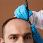 hair-transplant-surgery-2026-02-3eeef2a70ef3b844e370f66aa11701ab-1200x800-1