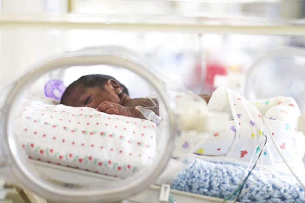 preterm-baby-2026-02-24e9b12ea448d8604915c40e6ea29d49-3x2-1