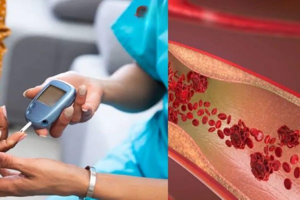 diabetes-Vascular-2026-03-a5efbe9b2d9450598840eda00954bb06-1200x800-1