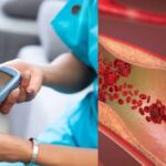 diabetes-Vascular-2026-03-a5efbe9b2d9450598840eda00954bb06-1200x800-1