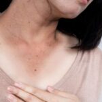 skin-dark-neck-2026-03-9588dd7862a6684376dc33e6ceaa689e-1200x800-1