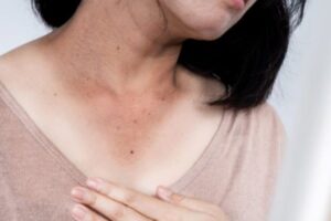 skin-dark-neck-2026-03-9588dd7862a6684376dc33e6ceaa689e-1200x800-1