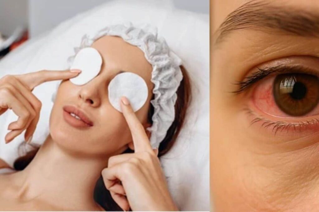 eye-2026-04-1963cfd57d7a978cf1225ef4d9854494-1200x800-1