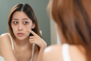 skin-care-tips-1-2026-06-f1381e0c0cd88e6b8eb043999afc0319-1200x800-1